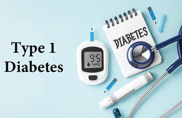 Type 1 Diabetes